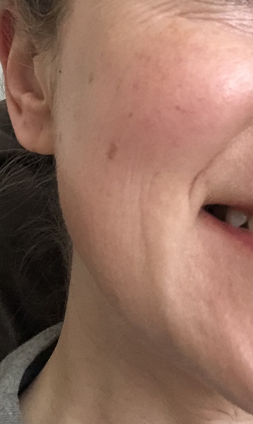 Please advise me about my skin