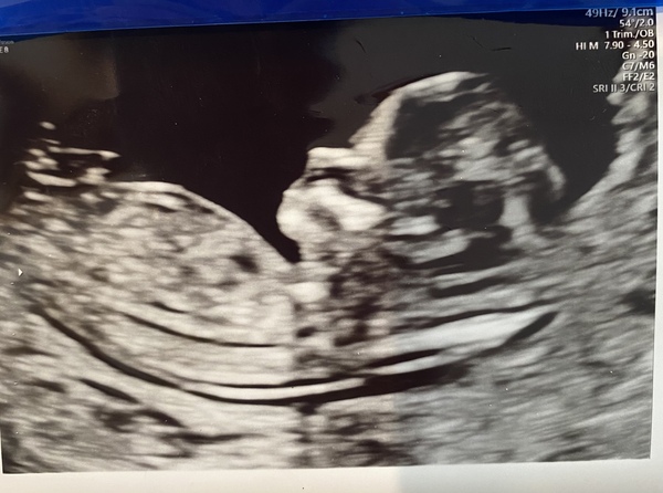 Girl or boy....?