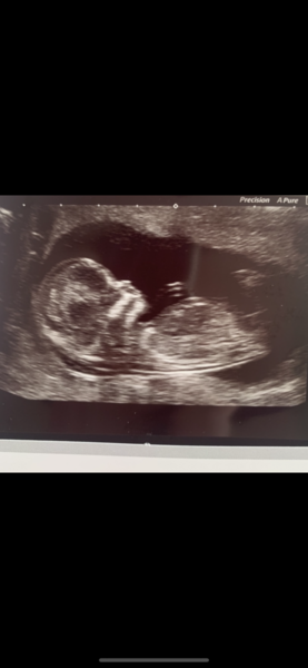 Guess the gender from my scan picture  (just for fun)