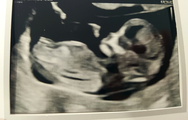 December babies 2021! Thread 4