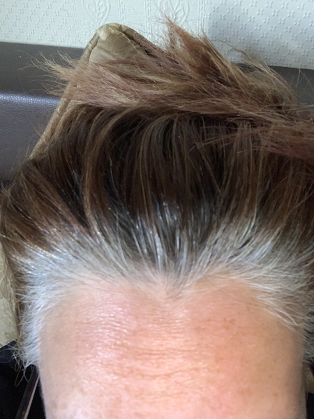 Grey hair - with pics