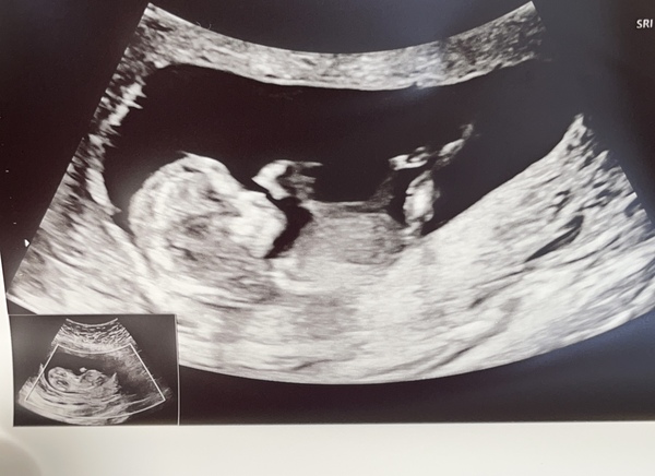 December babies 2021! Thread 4