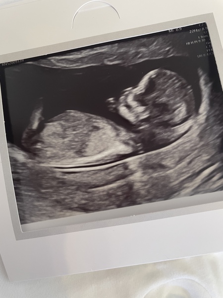 Gender guess?
