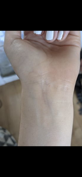 What is my skin undertone?