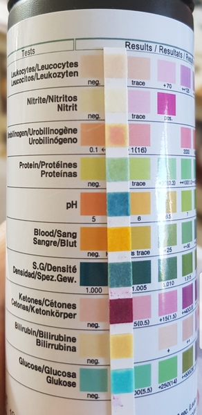 Home test high ketones? Picture