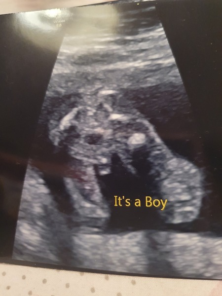Baby boys scan