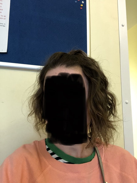 Hair woe *pics*