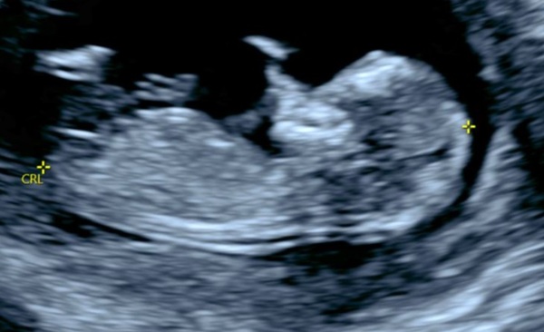 Potty and nub shots! Boy or Girl? :)