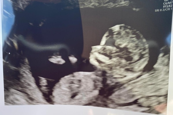 Gender guesses!?