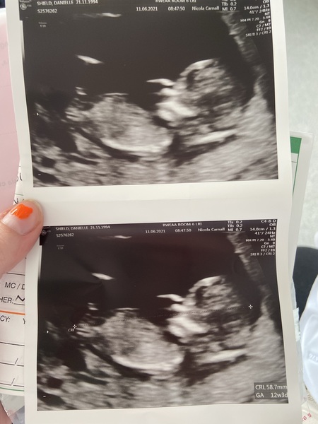 Any gender guesses? 12+3