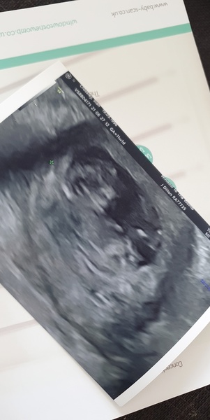 11+1 boy or girl what do we think?