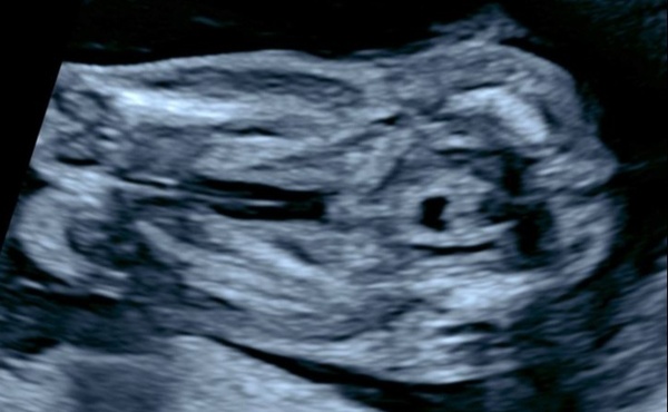 Potty and nub shots! Boy or Girl? :)