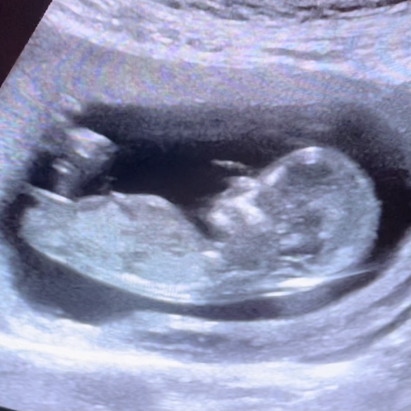 Gender guesses?!
