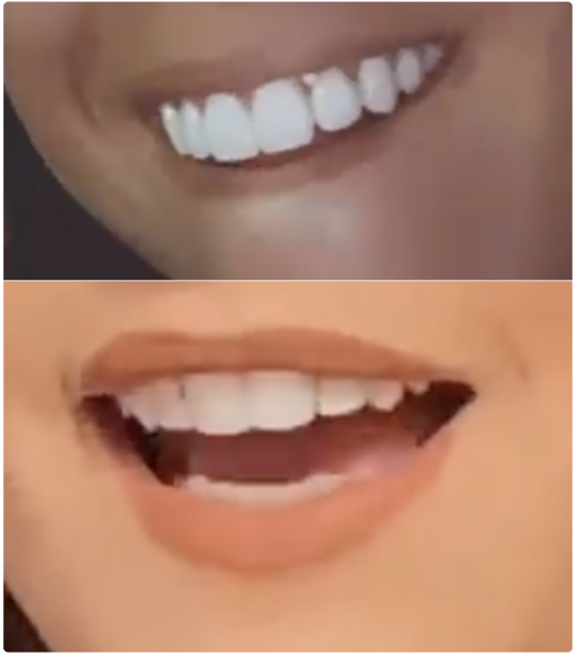 AIBU to think you can't whiten your natural teeth to this extent?