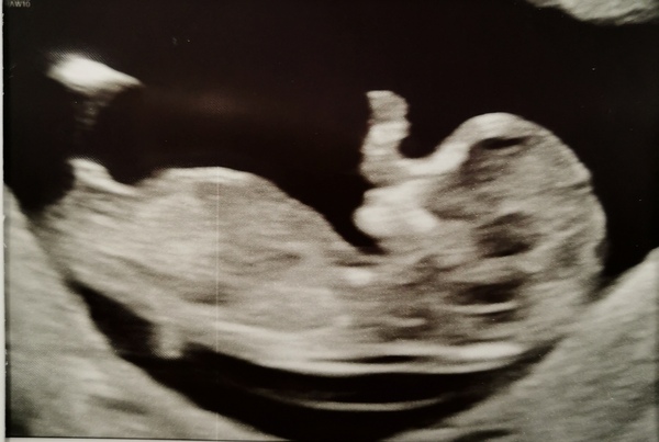 12+1 scan - nub theory guesses