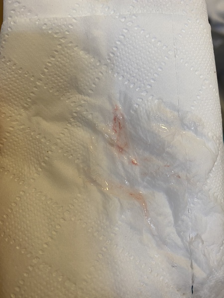 Can someone help me with this discharge