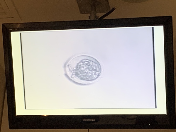 IVF May Part 2