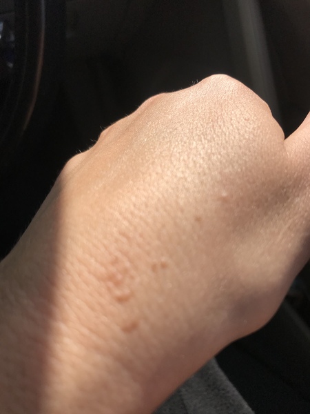 What is this on my hand? Pics