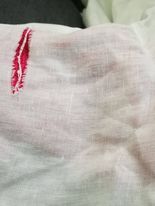 Anyone able to recommend something to repair a rip in a linen top?