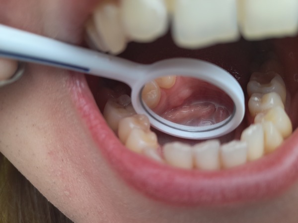 Lump in mouth..... an ideas?!