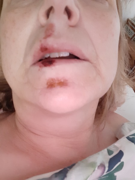 Week 9 - very much hoping this is our last fortnight!