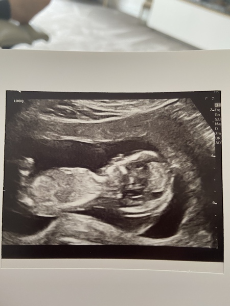 Gender guesses