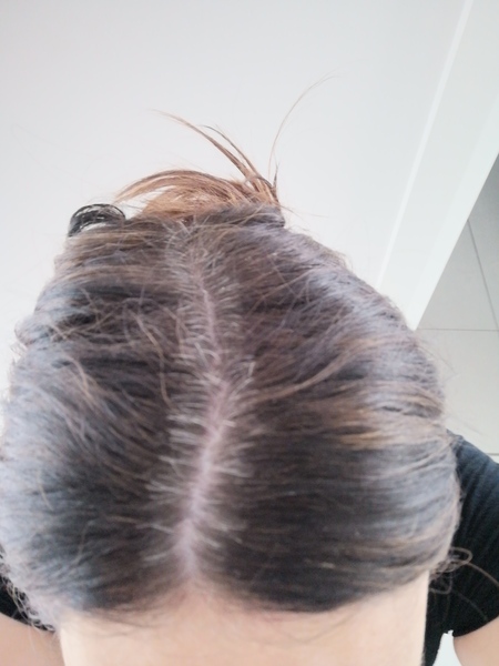 Grey hair - with pics
