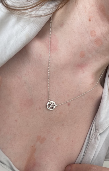 Is this a dermatitis type thing?