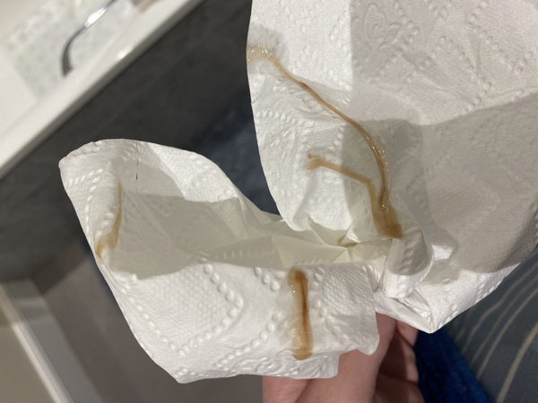 TMI is this normal 3 weeks after birth?