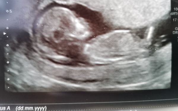 December babies 2021! Thread 4