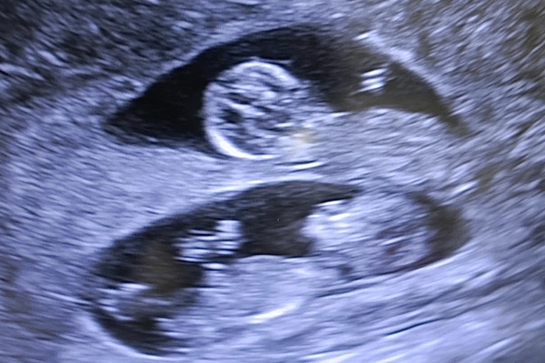 December babies 2021! Thread 4