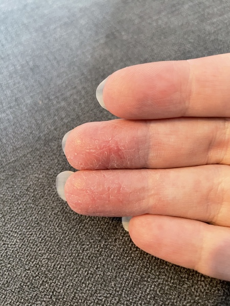 What is this on my fingers?!