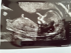 Gender guesses?!