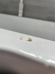 Mucus plug