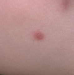 What’s on my DD’s leg?