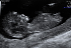 Gender guesses?