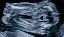 Potty and nub shots! Boy or Girl? :)