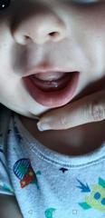Tooth??