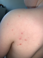 Spots! Any idea what these could be