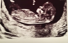 Boy or girl?!