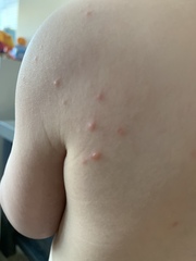 Spots! Any idea what these could be