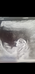 Gender guesses?