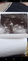 Boy or girl scan (Just for fun!)