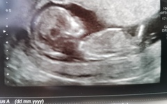 Boy or girl?!