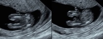 Potty and nub shots! Boy or Girl? :)