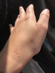 What is this on my hand? Pics