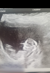 12 week scan - gender guess?