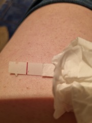 Symptom spotting- who else?