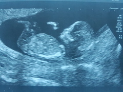 13 week scan... any gender guesses?