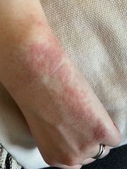 Best hand cream for sore hands?